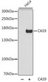Streptococcus pyogenes CRISPR-associated endonuclease Cas9/Csn1 Antibody - Western blot analysis of extracts of wild HeLa cells and Hela transfected with cas9, using CAS9 antibody at 1:5000 dilution. The secondary antibody used was an HRP Goat Anti-Rabbit IgG (H+L) at 1:10000 dilution. Lysates were loaded 25ug per lane and 3% nonfat dry milk in TBST was used for blocking. An ECL Kit was used for detection and the exposure time was 1s.