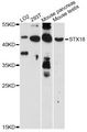 STX18 / Syntaxin 18 Antibody - Western blot analysis of extracts of various cell lines, using STX18 antibody at 1:3000 dilution. The secondary antibody used was an HRP Goat Anti-Rabbit IgG (H+L) at 1:10000 dilution. Lysates were loaded 25ug per lane and 3% nonfat dry milk in TBST was used for blocking. An ECL Kit was used for detection and the exposure time was 90s.