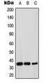 STX1A / Syntaxin 1A Antibody - Western blot analysis of Syntaxin 1A expression in MCF7 (A); mouse brain (B); rat brain (C) whole cell lysates.