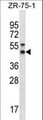 STX5 / Syntaxin 5 Antibody - STX5 Antibody western blot of ZR-75-1 cell line lysates (35 ug/lane). The STX5 antibody detected the STX5 protein (arrow).