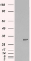 STX6 / Syntaxin 6 Antibody - HEK293 overexpressing Human STX6 (RC202951) and probed with (mock transfection in first lane).
