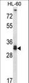 STX6 / Syntaxin 6 Antibody - STX6 Antibody western blot of HL-60 cell line lysates (35 ug/lane). The STX6 antibody detected the STX6 protein (arrow).