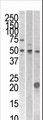 STYK1 Antibody - The anti- STYK1 antibody is used in Western blot to detect STYK1 in 293 , CEM , and mouse kidney cell line/tissue lysates.