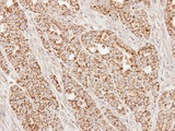 SUCLG1 / GALPHA Antibody - IHC of paraffin-embedded N87 xenograft using SUCLG1 antibody at 1:100 dilution.