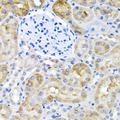 SULT1A1 / Sulfotransferase 1A1 Antibody - Immunohistochemistry of paraffin-embedded rat kidney using SULT1A1 antibodyat dilution of 1:100 (40x lens).
