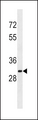 SULT1A2 / Sulfotransferase 1A2 Antibody - SULT1A2 Antibody western blot of K562 cell line lysates (35 ug/lane). The SULT1A2 antibody detected the SULT1A2 protein (arrow).