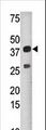 SULT1C2 / Sulfotransferase 1C2 Antibody - Western blot of anti-SULT1C2 antibody in mouse liver tissue lysate (35 ug/lane). SULT1C2(arrow) was detected using the purified antibody.