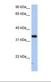 SULT6B1 / Sulfotransferase 6B1 Antibody - HepG2 cell lysate. Antibody concentration: 1.0 ug/ml. Gel concentration: 12%.  This image was taken for the unconjugated form of this product. Other forms have not been tested.