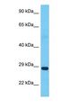 SUNC1 / SUN3 Antibody - Western blot of SUN3 Antibody with human Uterus Tumor lysate.  This image was taken for the unconjugated form of this product. Other forms have not been tested.
