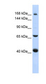 SUR2 / ABCC9 Antibody - ABCC9 antibody Western blot of 721_B cell lysate. This image was taken for the unconjugated form of this product. Other forms have not been tested.