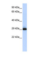 SUSD3 Antibody - SUSD3 antibody Western blot of Placenta lysate. This image was taken for the unconjugated form of this product. Other forms have not been tested.