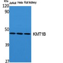 SUV39H2 Antibody - Western blot of KMT1B antibody