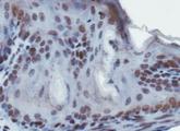 SUV420H1 Antibody - Immunohistochemistry: SUV420h1 Antibody - IHC analysis of SUV420h1 in mouse epidermis using DAB with hematoxylin counterstain.  This image was taken for the unconjugated form of this product. Other forms have not been tested.