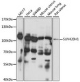 SUV420H1 Antibody - Western blot analysis of extracts of various cell lines, using SUV420H1 antibody at 1:1000 dilution. The secondary antibody used was an HRP Goat Anti-Rabbit IgG (H+L) at 1:10000 dilution. Lysates were loaded 25ug per lane and 3% nonfat dry milk in TBST was used for blocking. An ECL Kit was used for detection and the exposure time was 90s.