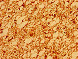 SV2A / SV Antibody - Immunohistochemistry image of paraffin-embedded human brain tissue at a dilution of 1:100