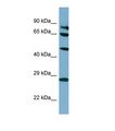 SV2B Antibody - Western blot of Human HT1080. SV2B antibody dilution 1.0 ug/ml.  This image was taken for the unconjugated form of this product. Other forms have not been tested.