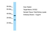 SYCE2 Antibody -  This image was taken for the unconjugated form of this product. Other forms have not been tested.