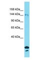 SYDE2 Antibody - SYDE2 antibody Western Blot of OVCAR-3. Antibody dilution: 1 ug/ml.  This image was taken for the unconjugated form of this product. Other forms have not been tested.