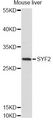 SYF2 / p29 Antibody - Western blot analysis of extracts of mouse liver, using SYF2 antibody at 1:1000 dilution. The secondary antibody used was an HRP Goat Anti-Rabbit IgG (H+L) at 1:10000 dilution. Lysates were loaded 25ug per lane and 3% nonfat dry milk in TBST was used for blocking. An ECL Kit was used for detection and the exposure time was 90s.