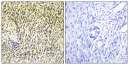 SYK Antibody - Immunohistochemistry analysis of paraffin-embedded human ovary tissue, using SYK Antibody. The picture on the right is blocked with the synthesized peptide.