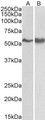 SYN / FYN Antibody - Goat Anti-FYN Antibody (0.3µg/ml) staining of A431 (A) and Jurkat lysate (B) (35µg protein in RIPA buffer). Primary incubation was 1 hour. Detected by chemiluminescencence.