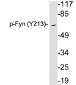 SYN / FYN Antibody - Western blot analysis of lysates from brain tissue, using phospho-Fyn (Phospho-Tyr213) antibody.