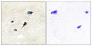 SYN1 / Synapsin 1 Antibody - Immunohistochemistry analysis of paraffin-embedded human brain, using Synapsin1 (Phospho-Ser605) Antibody. The picture on the right is blocked with the phospho peptide.