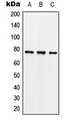 SYN1 / Synapsin 1 Antibody - Western blot analysis of Synapsin 1 (pS62) expression in SKNSH nocodazole-treated (A); mouse brain (B); rat brain (C) whole cell lysates.