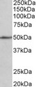 SYNCAM / CADM1 Antibody - CADM1 antibody (1 ug/ml) staining of Mouse fetal Heart lysate (35 ug protein in RIPA buffer). Primary incubation was 1 hour. Detected by chemiluminescence.