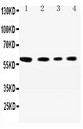 SYNCAM / CADM1 Antibody - WB of SYNCAM / CADM1 antibody. All lanes: Anti-CADM1 at 0.5ug/ml. Lane 1: A549 Whole Cell Lysate at 40ug. Lane 2: JURKAT Whole Cell Lysate at 40ug. Lane 3: RAJI Whole Cell Lysate at 40ug. Lane 4: HELA Whole Cell Lysate at 40ug. Predicted bind size: 60KD. Observed bind size: 60KD.