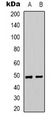 SYNCAM / CADM1 Antibody - Western blot analysis of CADM1 expression in A549 (A); HEK293T (B) whole cell lysates.