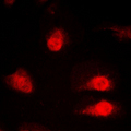 SYNCRIP / HnRNP Q Antibody - Immunofluorescent analysis of hnRNP Q staining in HeLa cells. Formalin-fixed cells were permeabilized with 0.1% Triton X-100 in TBS for 5-10 minutes and blocked with 3% BSA-PBS for 30 minutes at room temperature. Cells were probed with the primary antibody in 3% BSA-PBS and incubated overnight at 4 C in a humidified chamber. Cells were washed with PBST and incubated with a DyLight 594-conjugated secondary antibody (red) in PBS at room temperature in the dark. DAPI was used to stain the cell nuclei (blue).