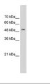 Syndapin I / PACSIN1 Antibody - Transfected 293T Cell Lysate.  This image was taken for the unconjugated form of this product. Other forms have not been tested.