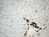 SYNE1 / Nesprin 1 Antibody - Immunohistochemical staining of paraffin-embedded Human liver tissue within the normal limits using anti-SYNE1 mouse monoclonal antibody. (Heat-induced epitope retrieval by 1mM EDTA in 10mM Tris buffer. (pH8.5) at 120°C for 3 min. (1:500)