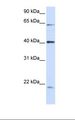 SYNE4 / C19orf46 Antibody - 293T cell lysate. Antibody concentration: 1.0 ug/ml. Gel concentration: 12%.  This image was taken for the unconjugated form of this product. Other forms have not been tested.