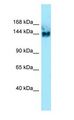 SYNGAP Antibody - SYNGAP antibody Western Blot of Fetal kidney.  This image was taken for the unconjugated form of this product. Other forms have not been tested.