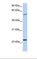 SYNGR2 / Synaptogyrin 2 Antibody - 721_B cell lysate. Antibody concentration: 1.0 ug/ml. Gel concentration: 12%.  This image was taken for the unconjugated form of this product. Other forms have not been tested.