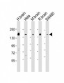 SYNJ1 / Synaptojanin Antibody - All lanes: Anti-SYNJ1 Antibody (C-term) at 1:1000-1:2000 dilution. Lane 1: human brain lysate. Lane 2: HeLa whole cell lysate. Lane 3: mouse brain lysate. Lane 4: rat brain lysate. Lane 5: SW480 whole cell lysate Lysates/proteins at 20 ug per lane. Secondary Goat Anti-Rabbit IgG, (H+L), Peroxidase conjugated at 1:10000 dilution. Predicted band size: 173 kDa. Blocking/Dilution buffer: 5% NFDM/TBST.