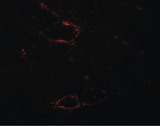 SYNPO2L Antibody - Immunofluorescence of SYNPO2L in mouse skeletal muscle tissue with SYNPO2L antibody at 20 ug/ml.