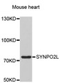 SYNPO2L Antibody - Western blot analysis of extracts of Mouse heart cells.