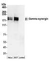 SYNRG Antibody - Detection of human Gamma-synergin by western blot. Samples: Whole cell lysate (50 µg) from HeLa, HEK293T, and Jurkat cells prepared using NETN lysis buffer. Antibodies: Affinity purified rabbit anti-Gamma-synergin antibody used for WB at 0.1 µg/ml. Detection: Chemiluminescence with an exposure time of 3 minutes.
