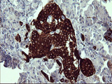 SYP / Synaptophysin Antibody - IHC of paraffin-embedded Human pancreas tissue using anti-SYP mouse monoclonal antibody.