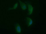 SYP / Synaptophysin Antibody - Immunofluorescent staining of HeLa cells using anti-SYP mouse monoclonal antibody.