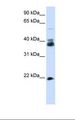 SYP / Synaptophysin Antibody - Transfected 293T cell lysate. Antibody concentration: 1.0 ug/ml. Gel concentration: 12%.  This image was taken for the unconjugated form of this product. Other forms have not been tested.