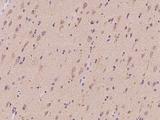 SYT11 Antibody - Immunochemical staining of human SYT11 in human brain with rabbit polyclonal antibody at 1:100 dilution, formalin-fixed paraffin embedded sections.