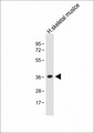 T2R5 / TAS2R5 Antibody - Anti-TAS2R5 Antibody (Center) at 1:1000 dilution + Human skeletal muslce lysate Lysates/proteins at 20 µg per lane. Secondary Goat Anti-Rabbit IgG, (H+L), Peroxidase conjugated at 1/10000 dilution. Predicted band size: 36 kDa Blocking/Dilution buffer: 5% NFDM/TBST.