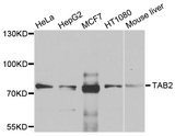 TAB2 Antibody - Western blot analysis of extracts of various cell lines.