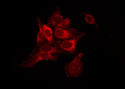 TACR2 / NK2R Antibody - Staining NIH-3T3 cells by IF/ICC. The samples were fixed with PFA and permeabilized in 0.1% Triton X-100, then blocked in 10% serum for 45 min at 25°C. The primary antibody was diluted at 1:200 and incubated with the sample for 1 hour at 37°C. An Alexa Fluor 594 conjugated goat anti-rabbit IgG (H+L) Ab, diluted at 1/600, was used as the secondary antibody.