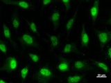 TADA3 / ADA3 Antibody - Immunostaining analysis in HeLa cells. HeLa cells were fixed with 4% paraformaldehyde and permeabilized with 0.1% Triton X-100 in PBS. The cells were immunostained with anti-TADA3L mAb.