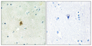 TAF15 Antibody - Immunohistochemistry analysis of paraffin-embedded human brain tissue, using TAF15 Antibody. The picture on the right is blocked with the synthesized peptide.